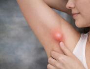 Koltuk Altındaki Şişlik Her Zaman Masum Değil: Ektopik Meme Dokusu Uyarısı